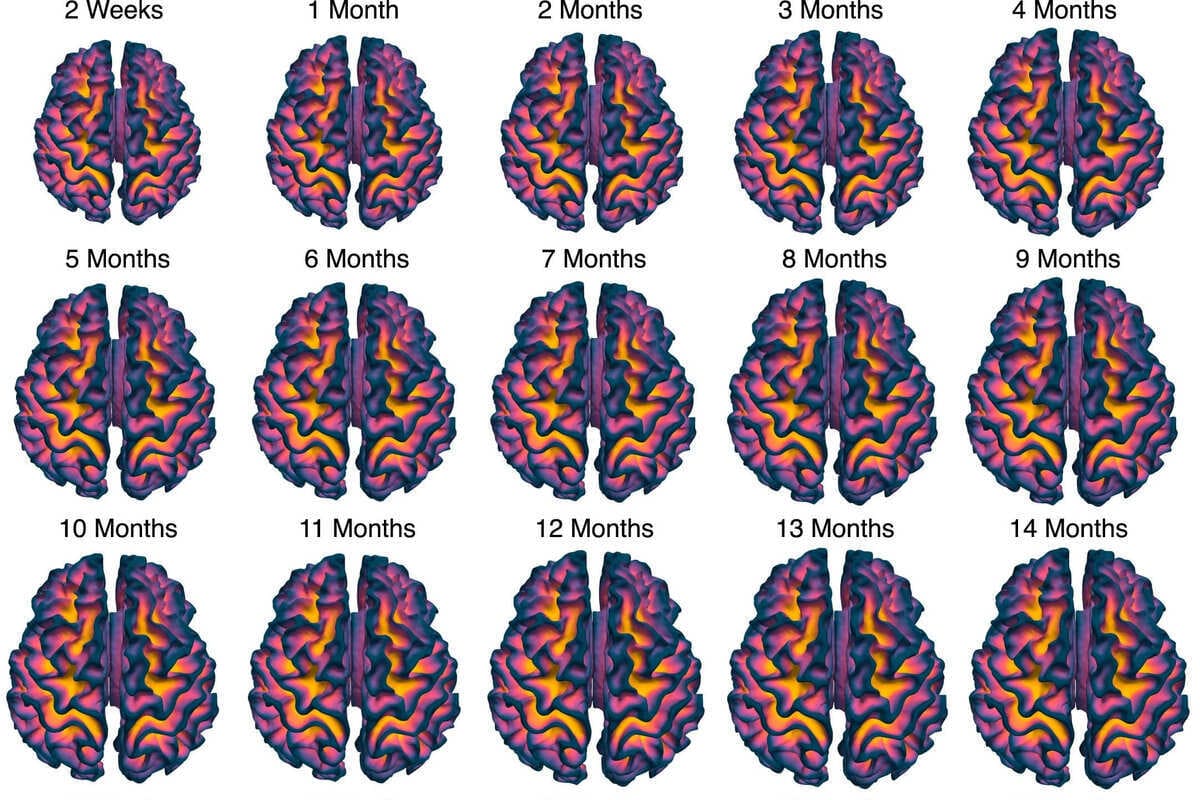 Investigadores revelan nuevos atlas del cerebro infantil, mes a mes