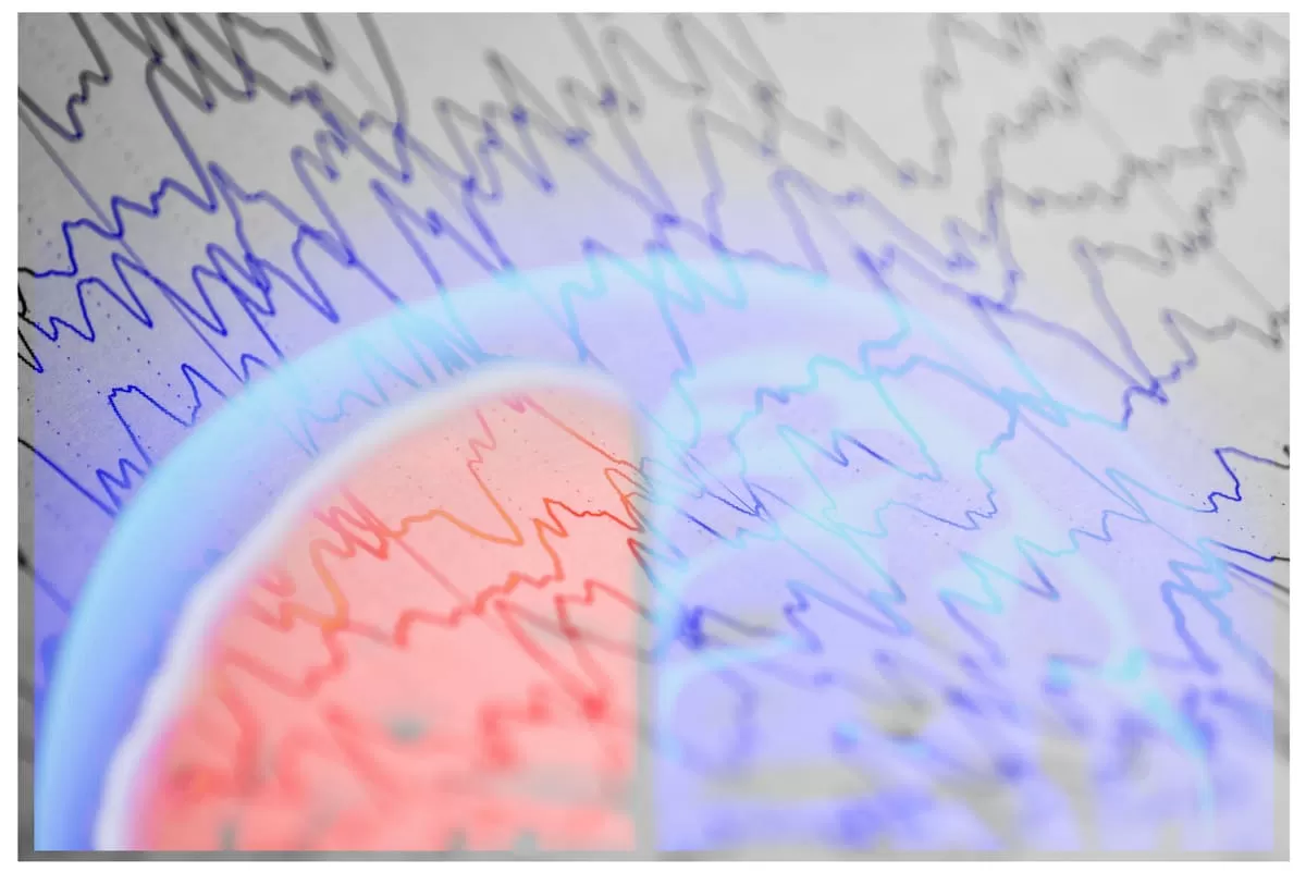 Adultos jóvenes, los más afectados por la epilepsia en Colombia