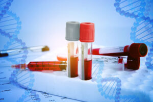 Europa autoriza uso de terapia génica para la hemofilia tipo B