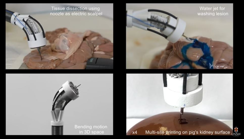 Robot hace bioimpresión 3D dentro del cuerpo humano