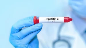 Servicios en salud para pacientes con hepatitis C