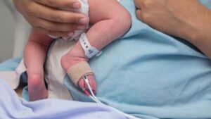 Tamiz neonatal para la prevención de discapacidad