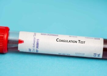 Análisis de costo-efectividad de anticoagulantes orales en pacientes con cáncer