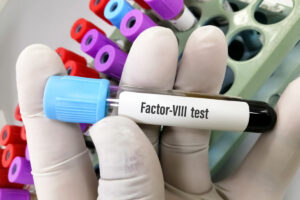 FDA aprueba primera terapia génica para hemofilia A