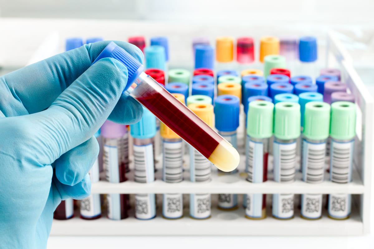Los biomarcadores una herramienta valiosa en la investigación médica y el cuidado de la salud