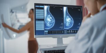Nuevos avances en la predicción del cáncer de mama posmenopáusico mediante inteligencia artificial