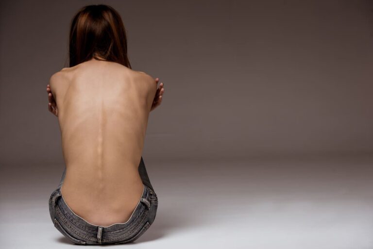 Psilocibina potencial tratamiento para la anorexia nerviosa