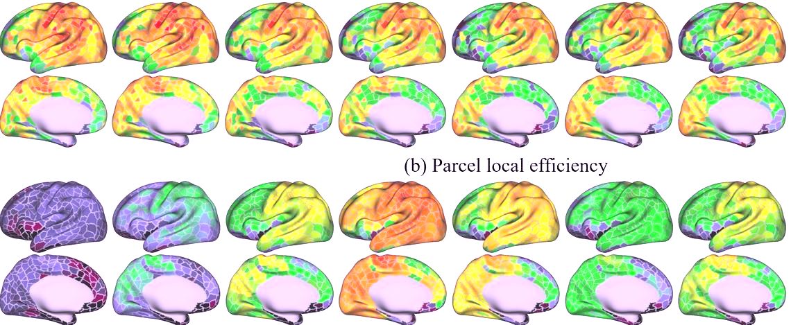 Crean primer atlas del cerebro infantil revela pistas de neurodesarrollo