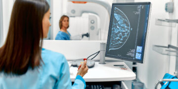 Descubrimientos sorprendentes desafían el modelo unicelular del cáncer de mama