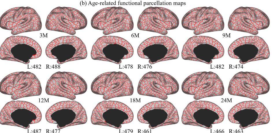 maoa cerebro infantil 2