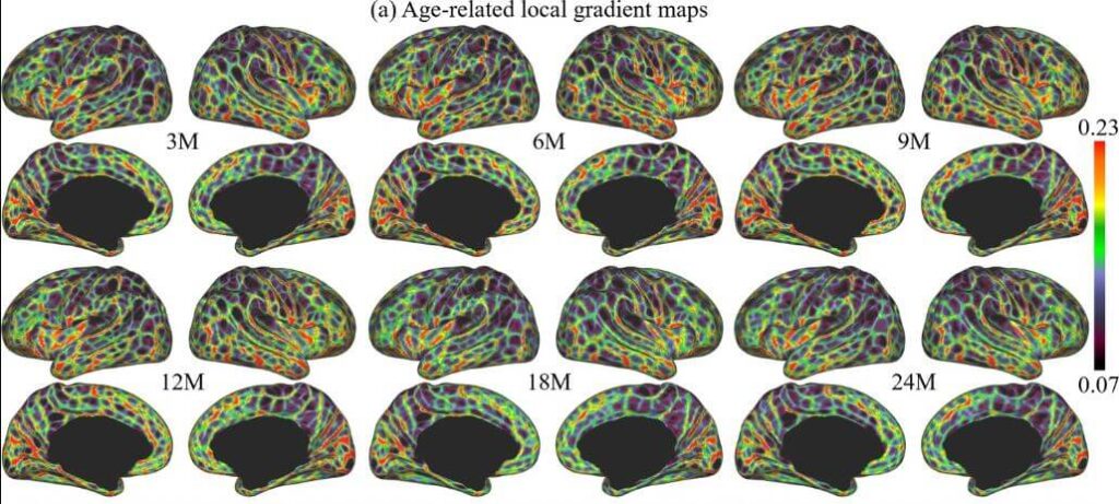mapa cerebro infantil 1