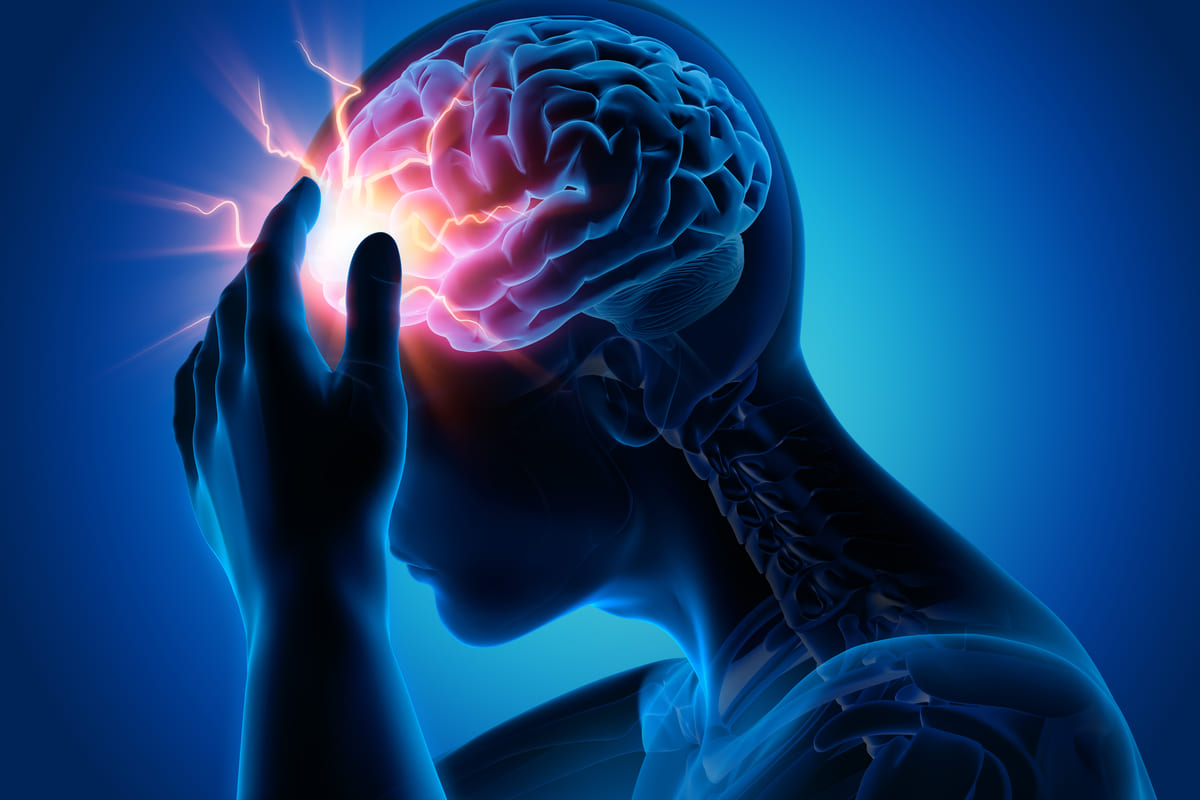 Lo que debes saber sobre la cefalea