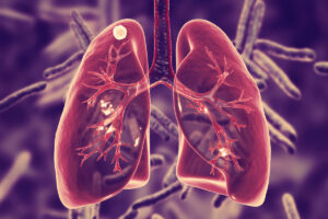 Nuevas metas para poner fin a la tuberculosis en el mundo
