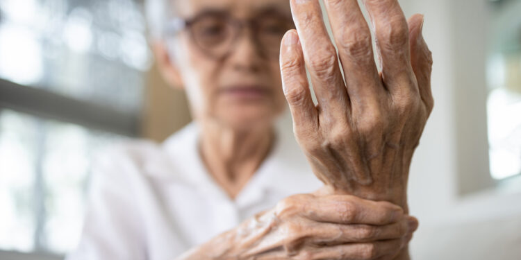 Tratamiento puente en artritis reumatoide: Riesgos y beneficios de su uso