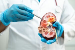 Enfermedad renal crónica en Colombia informe Cuenta de Alto Costo