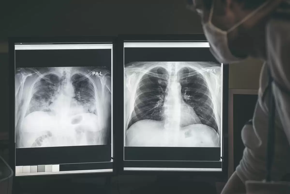 EPOC Medicina regenerativa basada en células madre