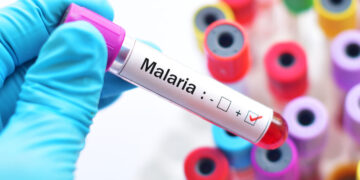 La cura para la malaria se vuelve aún más desafiante de lo esperado