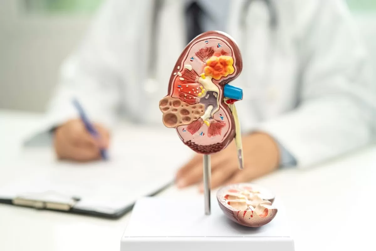 Aumenta mortalidad por enfermedad renal asociada a la diabetes en Latinoamérica