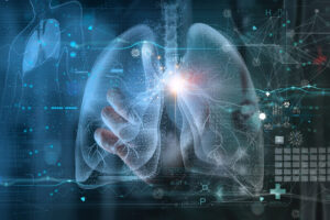 Avances en Inteligencia Artificial (IA) revolucionan el diagnóstico de tuberculosis pulmonar