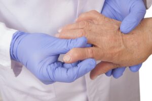Impacto económico de la optimización de terapias biológicas en artritis reumatoide y espondiloartritis
