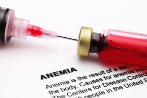 Lo que debes saber sobre la anemia