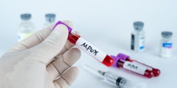 Colombia y Japón se unen en histórico estudio de vacuna contra el Mpox