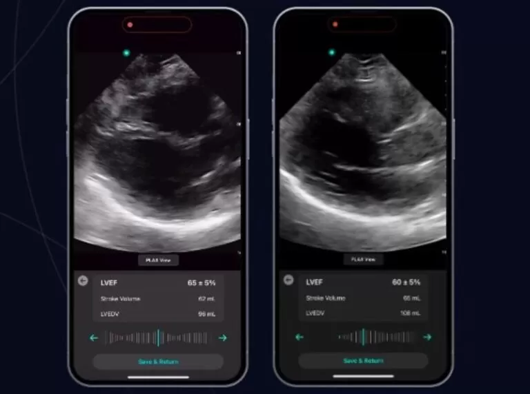 Reforma a la Salud 191 Exo potencia IA para diagnósticos por imagen desde smartphones