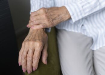 PARDAI-RA, nueva herramienta de clinimetría para mejorar el manejo de la artritis reumatoide en Latinoamérica