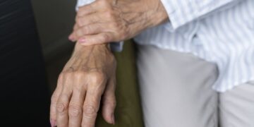 PARDAI-RA, nueva herramienta de clinimetría para mejorar el manejo de la artritis reumatoide en Latinoamérica