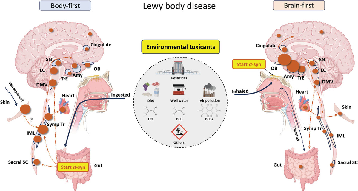 Toxinas en el ambiente ¿detonantes de la enfermedad de Parkinson