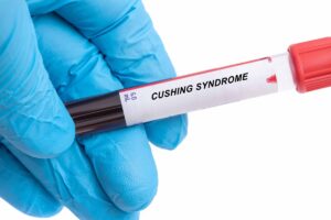 Día Mundial del Síndrome de Cushing: cerca del 5% de los colombianos podrían tener esta enfermedad y aún no estar diagnosticados