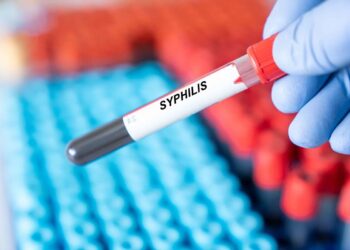 Aumento de los casos de sífilis en las Américas informó la OPS