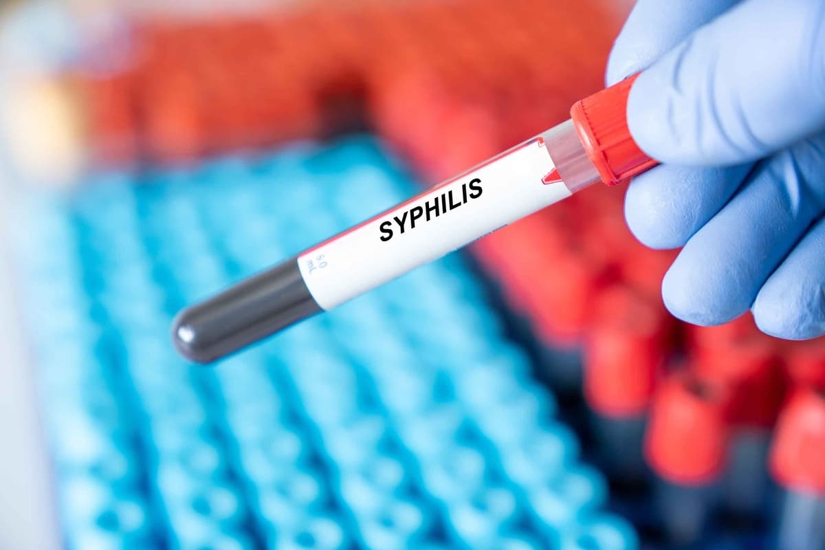 Aumento de los casos de sífilis en las Américas informó la OPS