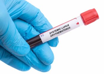 FDA aprueba el autoinyector de belimumab para el tratamiento del lupus eritematoso sistémico pediátrico