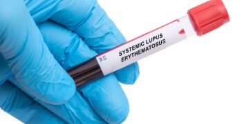 FDA aprueba el autoinyector de belimumab para el tratamiento del lupus eritematoso sistémico pediátrico