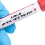 Una revolución en la genética: terapia única para la hipercolesterolemia familiar