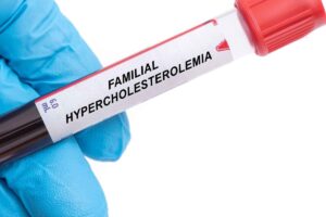 Una revolución en la genética: terapia única para la hipercolesterolemia familiar