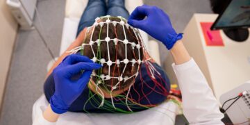 Electroencefalografía: una herramienta prometedora en la detección de la ELA