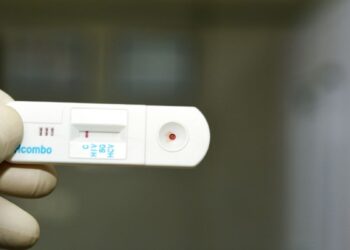 Argentina: Primer autotest disponible para el diagnóstico de VIH