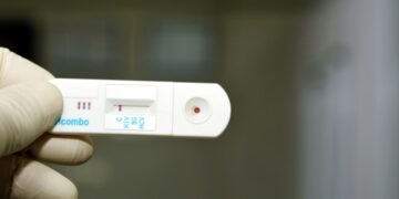 Argentina: Primer autotest disponible para el diagnóstico de VIH