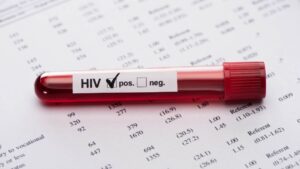 Alarma por el VIH en 2023, una muerte cada minuto y nuevas infecciones en aumento