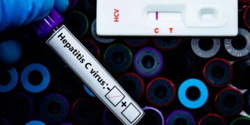 Primera prueba de autodiagnóstico de la hepatitis C ha sido precalificada por la OMS
