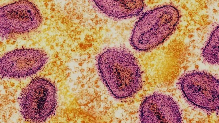 Reforma a la Salud 117 Cundinamarca sin riesgo de Mpox, refuerza medidas preventivas