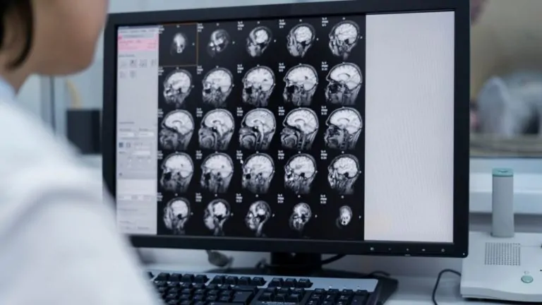 Reforma a la Salud 95 Innovación en el tratamiento de tumores cerebrales pediátricos con tecnología avanzada: INP