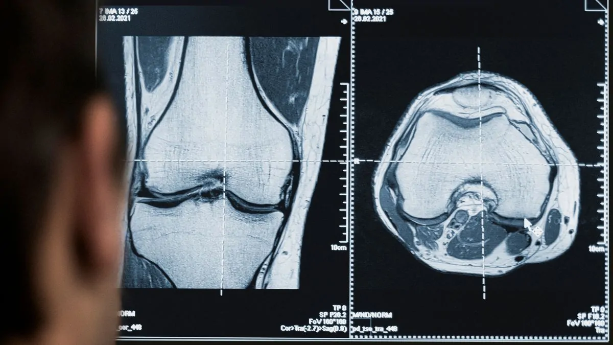 La radiología, un factor clave en la innovación de la salud