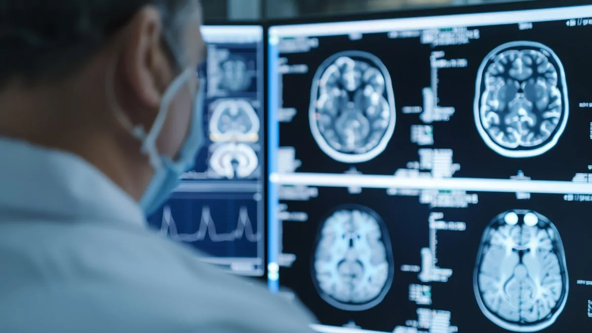 Acusan a Cassava Sciences de manipular datos en ensayos de Alzheimer