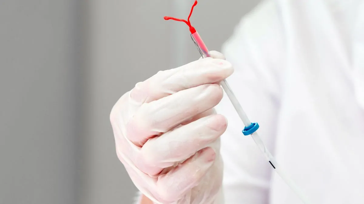 ¿El uso del DIU aumenta los riegos de cáncer de mama?