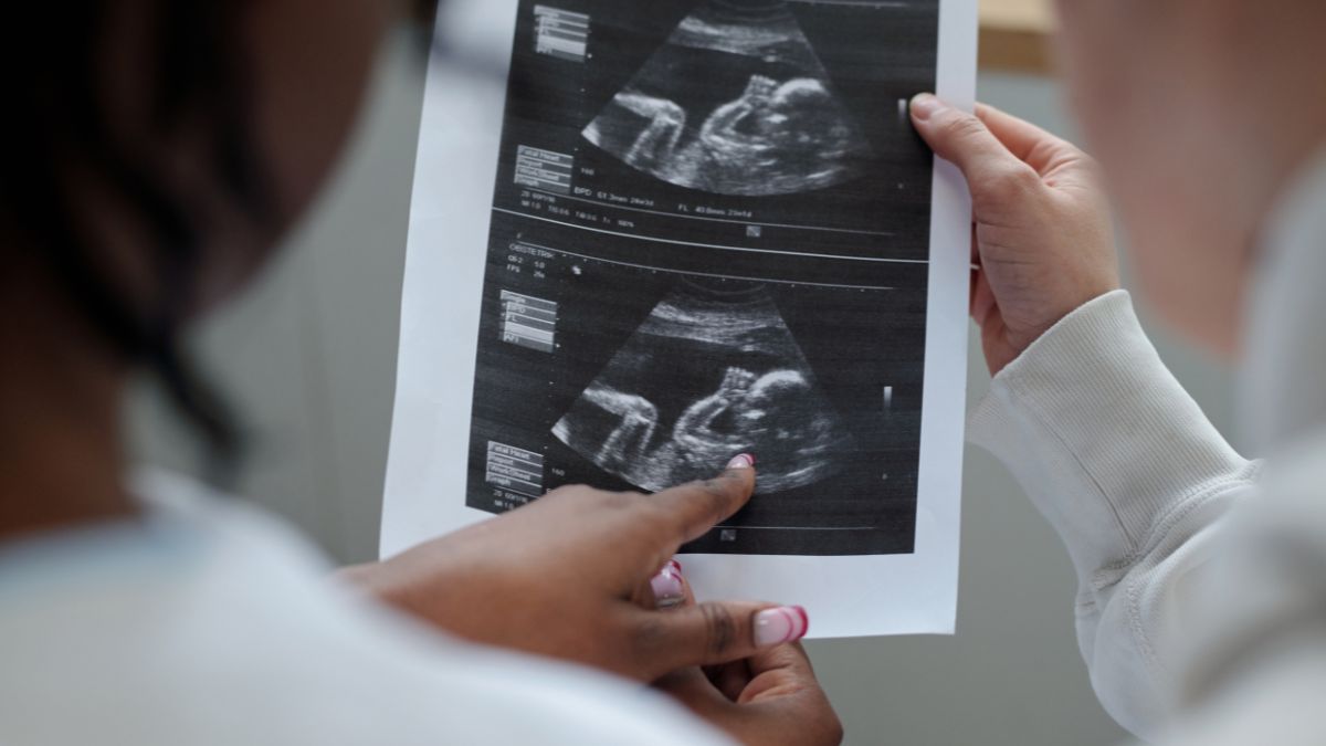 Escucha su latido propuesta centrada en el diagnóstico prenatal
