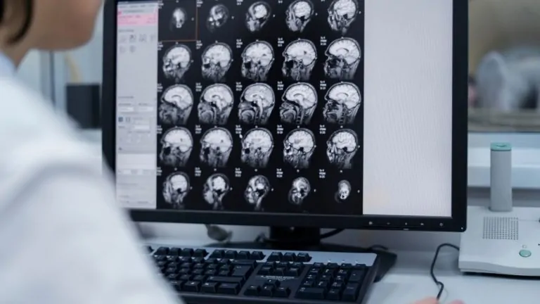 Reforma a la Salud 79 Philips y Medtronic se unen para mejorar el acceso al tratamiento del ictus (ACV)