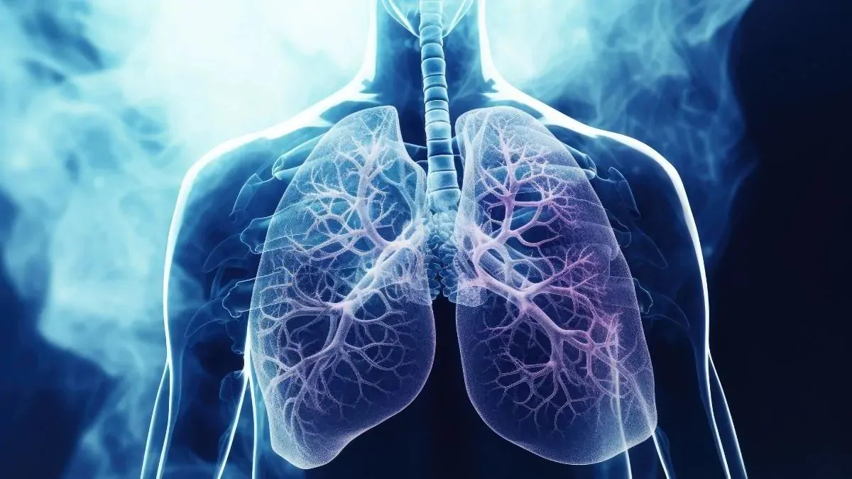 Avanzando hacia un modelo de gestión integral de las enfermedades respiratorias crónicas en Colombia